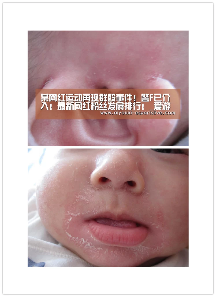 某网红运动再现群殴事件!警F已介入!最新网红粉丝发展排行!_爱游戏百家乐(图4) 爱游戏体育